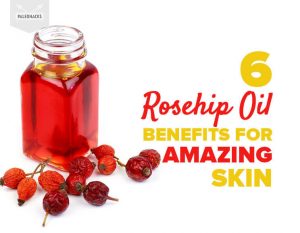 7 Rosehip Oil Benefits For Amazing Skin | Natural, Healthy