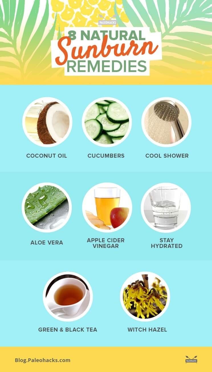 Infographic-8-natural-sunburn-remedies