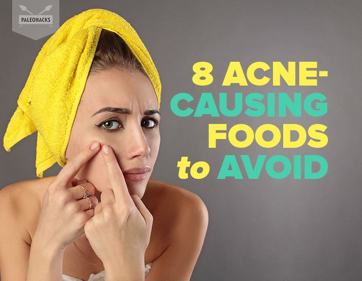 Acne-Causing Foods