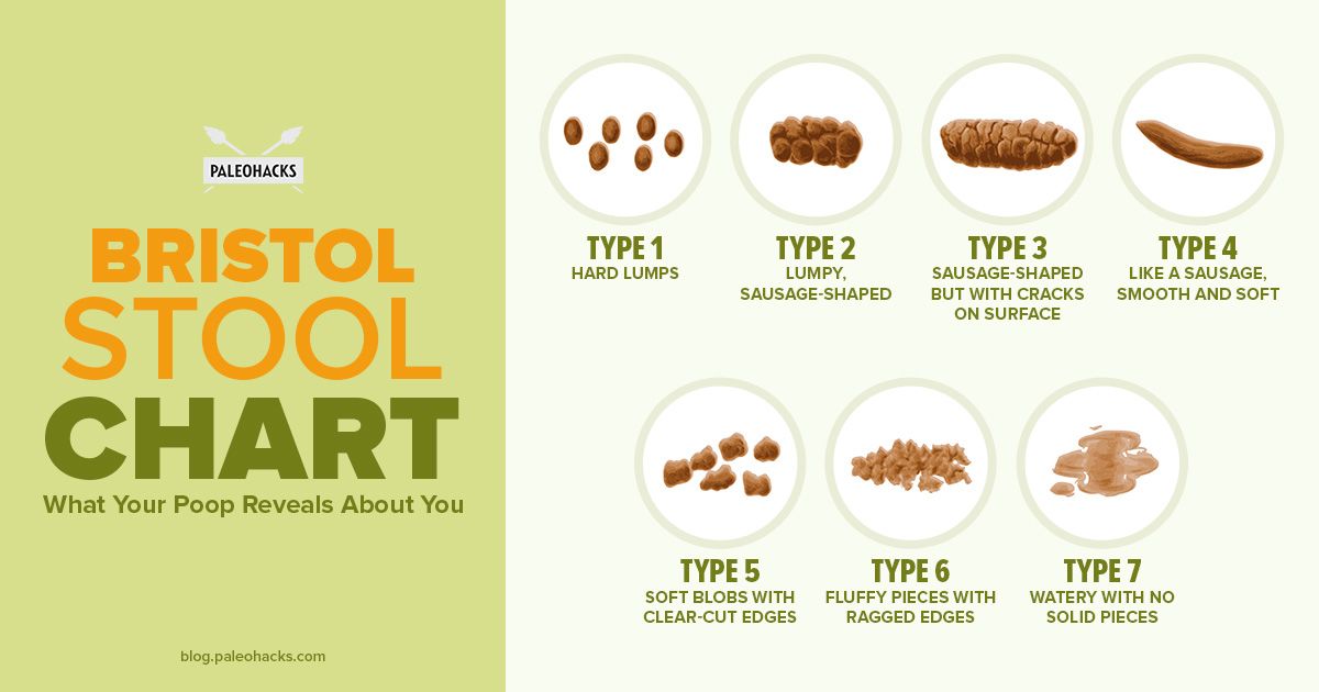 Stool Chart Type 6 Causes