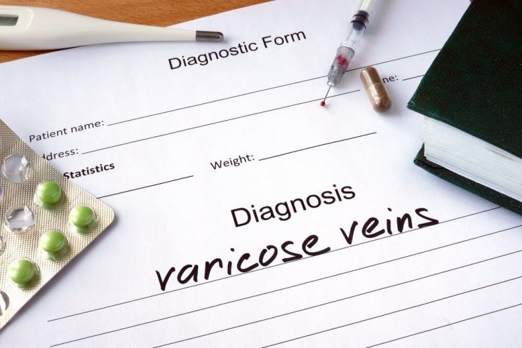 Diagnostic form with diagnosis varicose veins