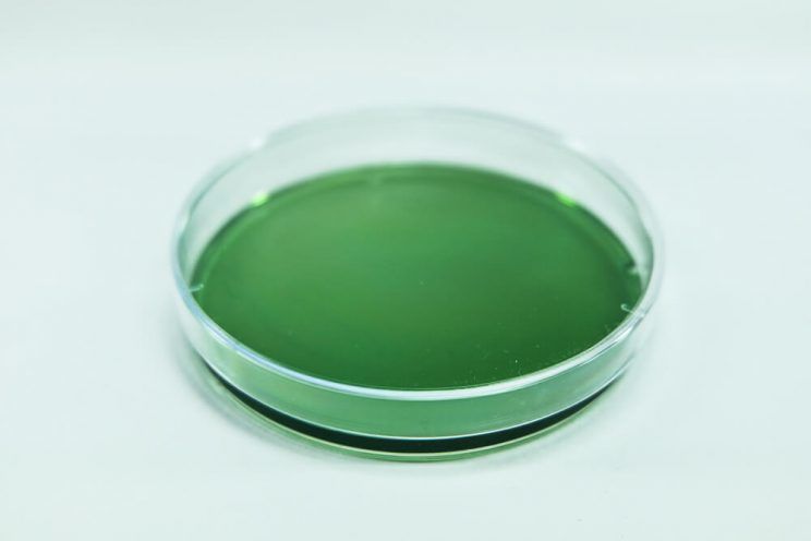 TCBS agar plate in microbiology
