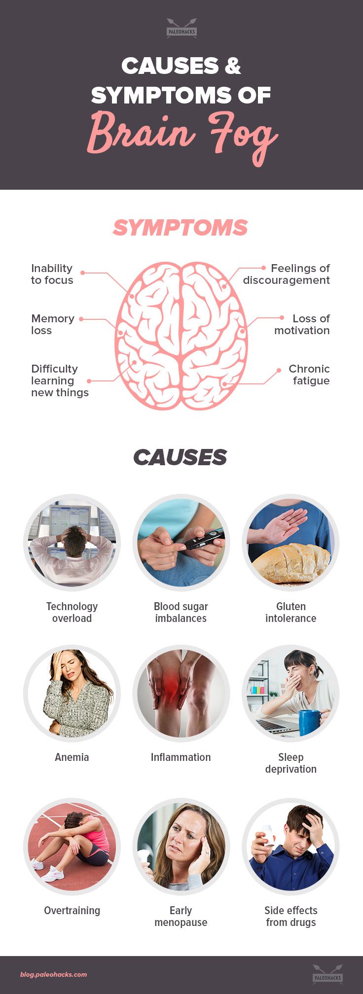 brain fog infographic