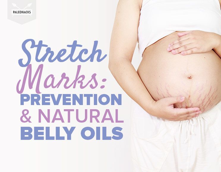 stretch marks title card