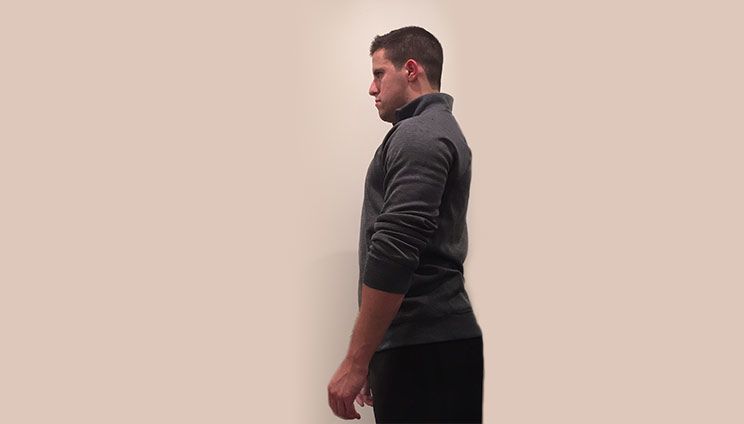 kypholordotic posture
