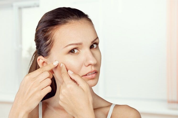 woman popping a zit