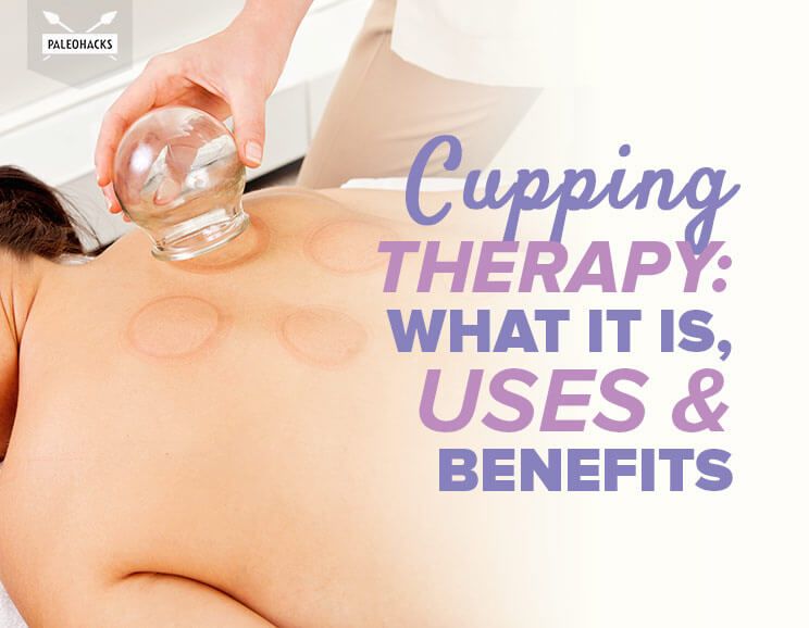 cupping therapy title card