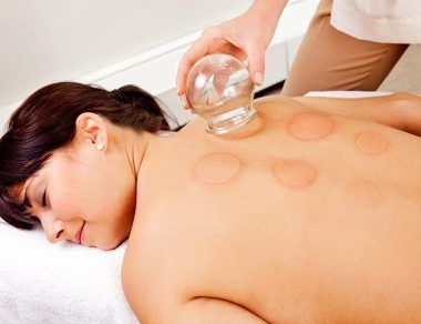cupping therapy featured image
