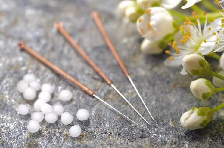 acupuncture needles