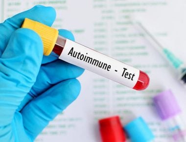 autoimmune disease featured image