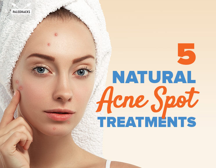 acne spots title card