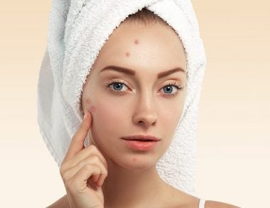 acne spots treatment featured image