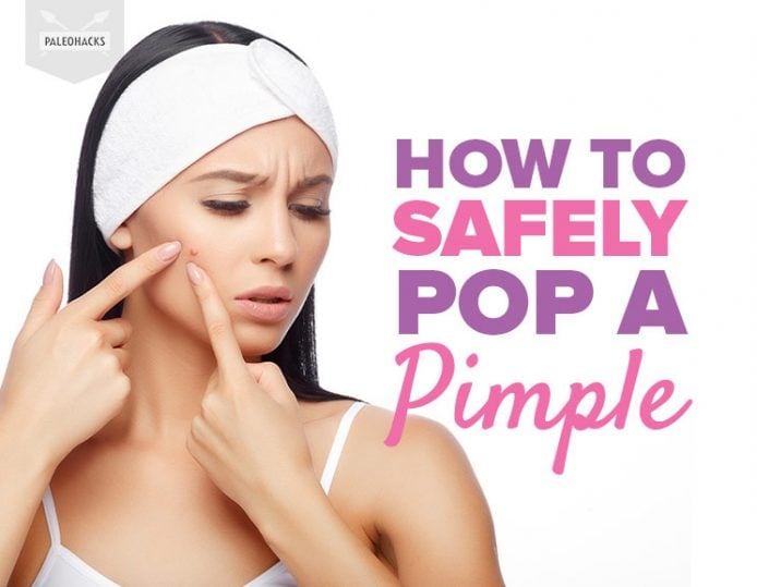 How To Safely Pop A Pimple and Avoid Scarring Or Infection 