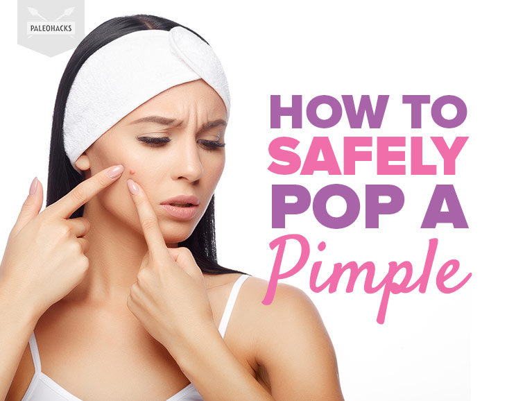 How to Safely Pop a Pimple