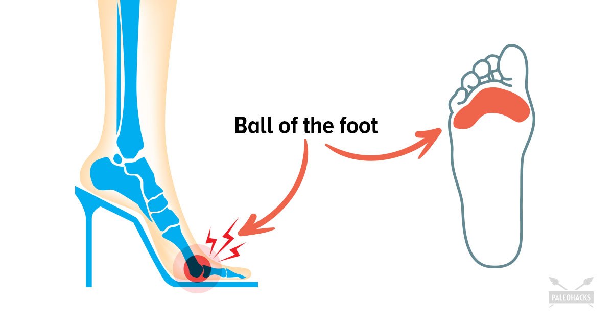 This Is What Happens To Your Body When You Wear Heels PaleoHacks