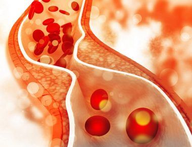 Understanding the Different Types of Cholesterol