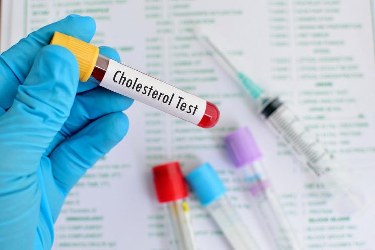 What Is Cholesterol