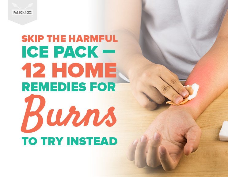 Skip The Harmful Ice Pack - 12 Home Remedies for Burns To Try Instead