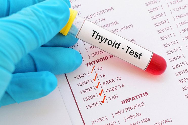 8 Ways to Take Control of Your Thyroid Health and Fertility