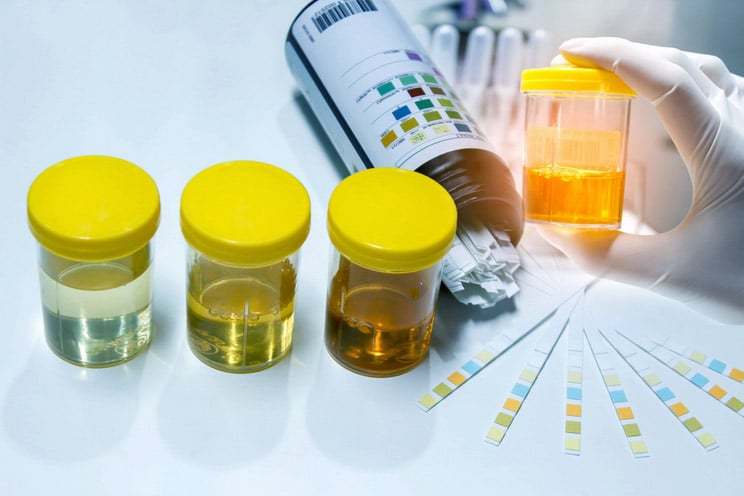 Why the Color of Your Urine Matters