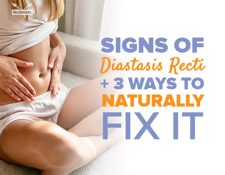 Signs of Diastasis Recti + 3 Ways to Naturally Fix It