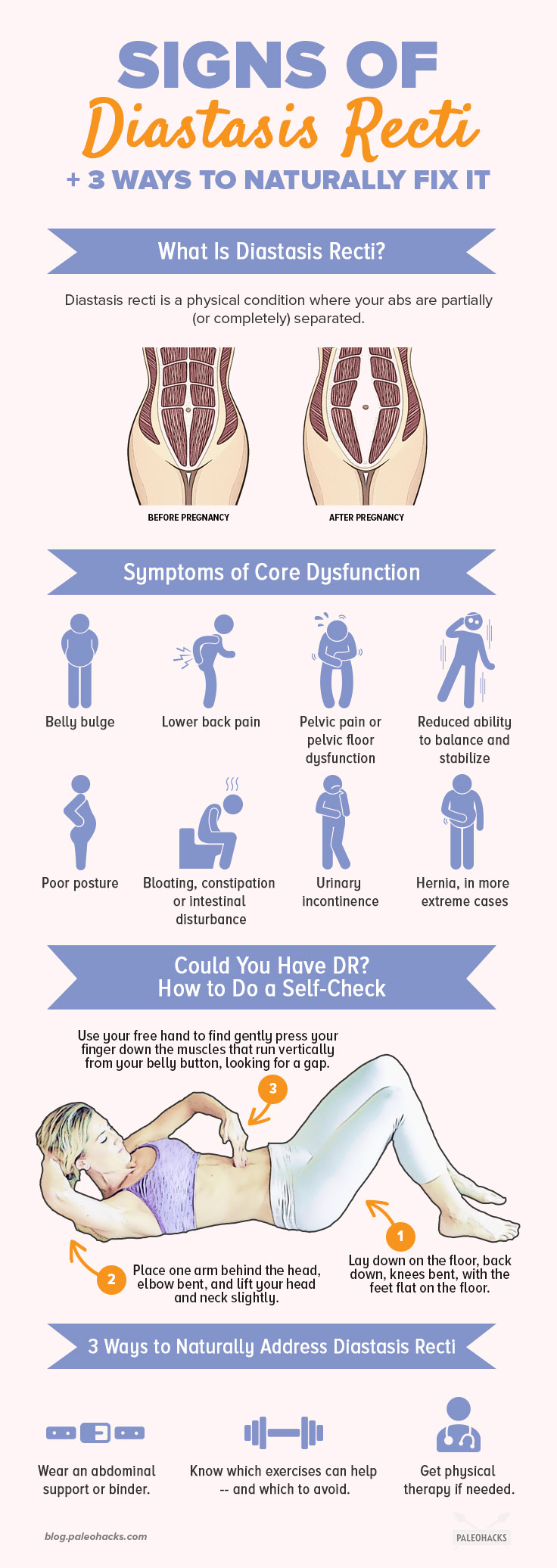 How To Tell If You Have Diastasis Recti Postpartum