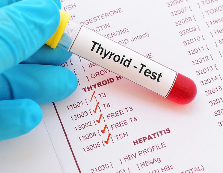 The Easy Guide to Decoding Your Thyroid Tests