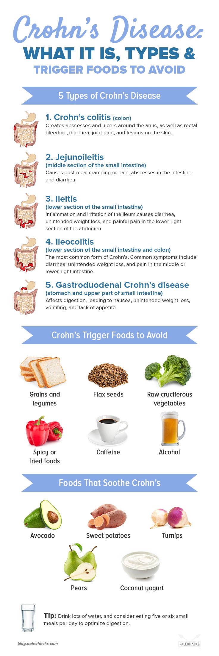 Crohn's Disease: What It Is, Types & Trigger Foods to ...
