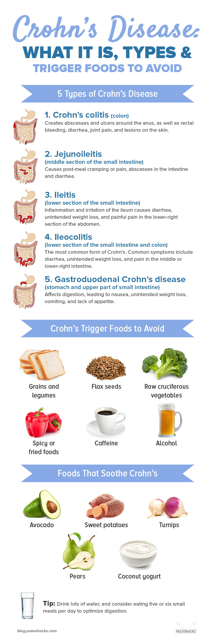 Featured image of post Crohn&#039;s Disease Flare Up Symptoms : Any part of the gut can be affected.