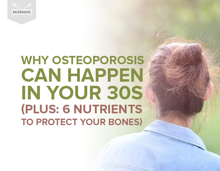 People think of osteoporosis as something that affects you as you get older, yet bone loss can start as early as your 30s.